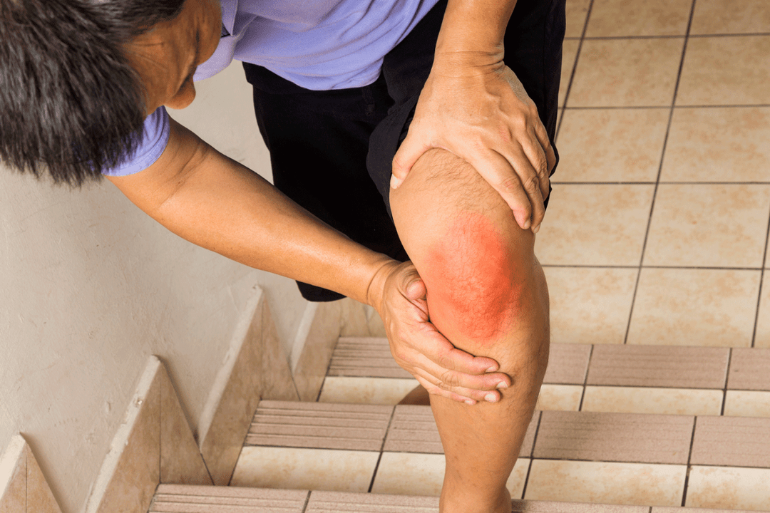 bolesti kloubů v důsledku artrózy