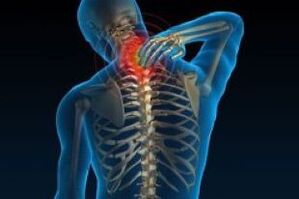 Cervikální osteochondrosis vede k bolestivosti v krku