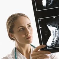 Diagnóza osteochondrosy je specifikována pomocí vyšetření x